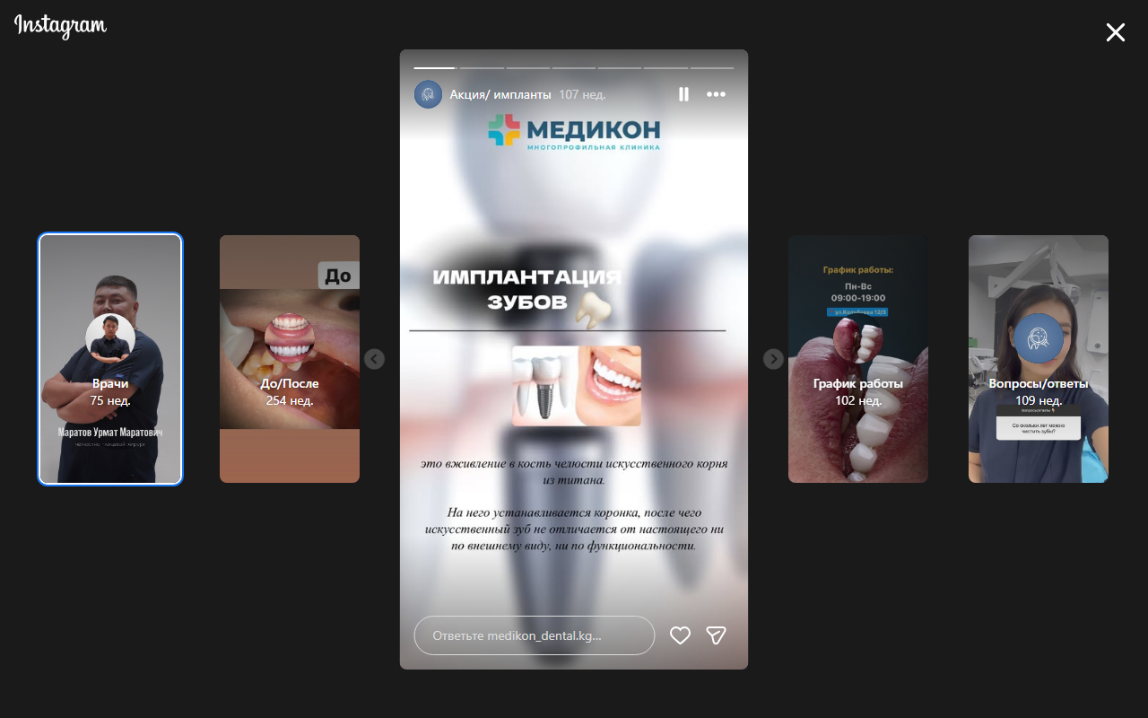 Имплантация зубов