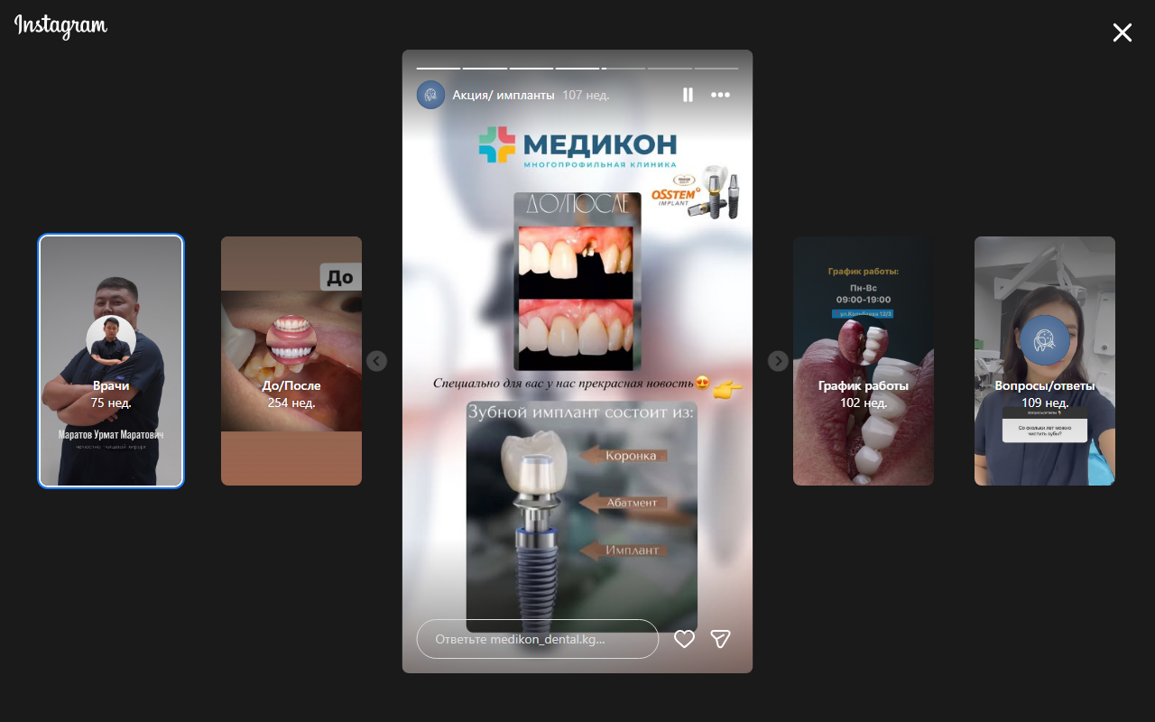 Результаты имплантации — до и после